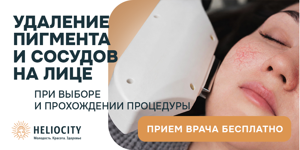 Удаление пигмента и сосудов на лице 